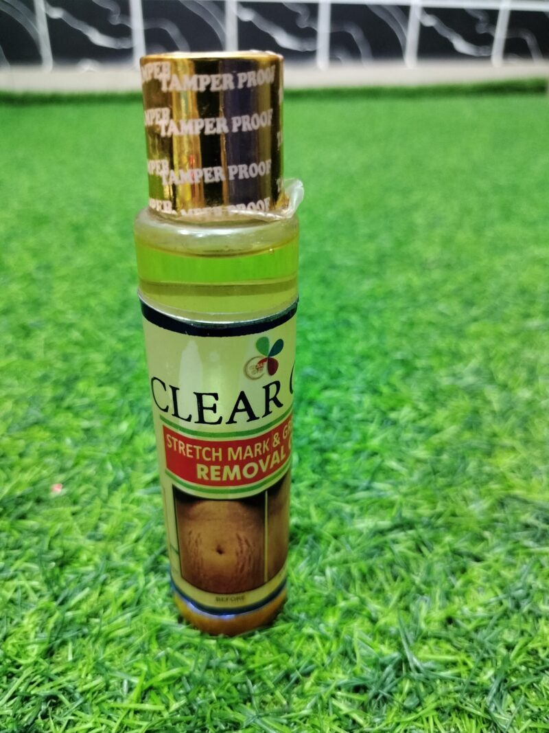 Clear Off Stretch Mark & Green Vein Removal Oil (100ml).